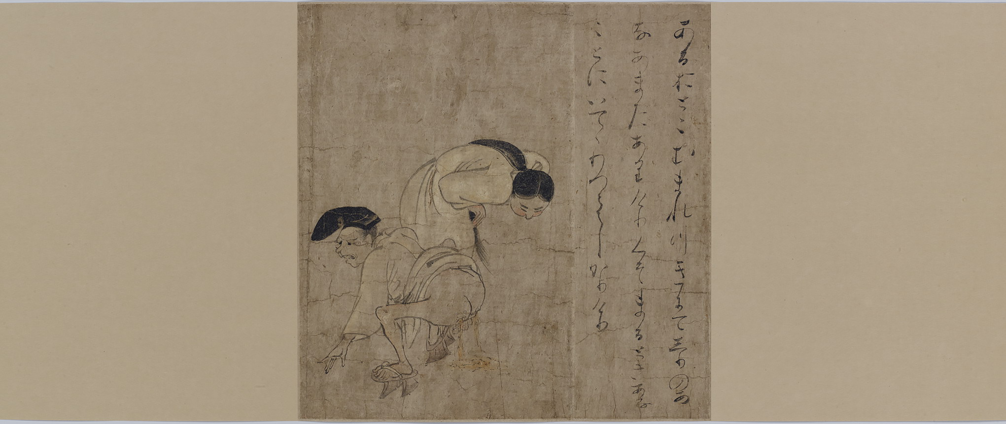 Man with Anal Fistula